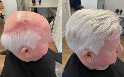 HLC Hair Systems
